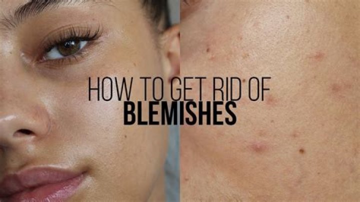 Blemish on a witch's nose