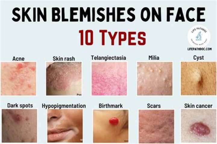 Blemish or damage