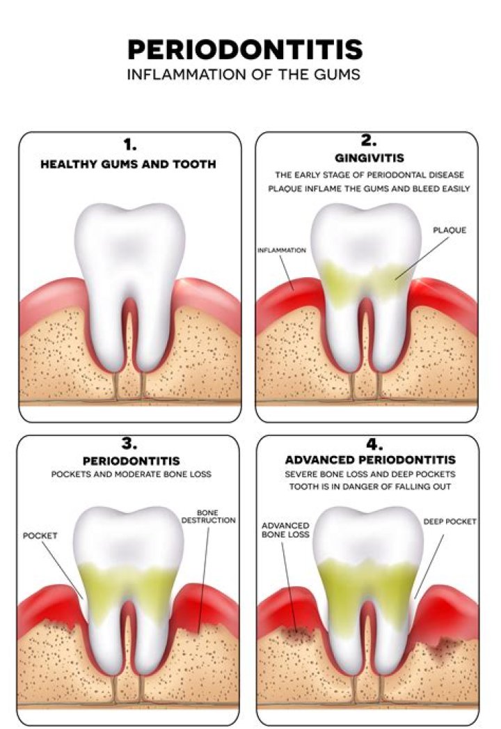 Body part that could suffer from periodontal disease