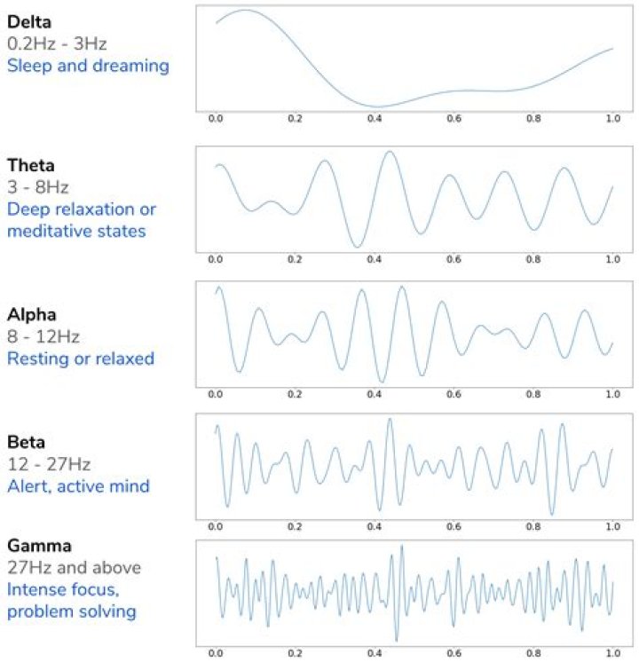 Brain-waves test at a hospital: Abbr.