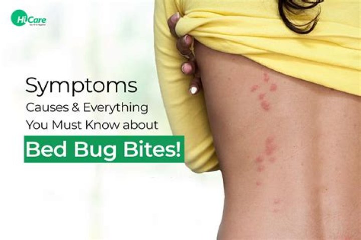 Bug bite symptom