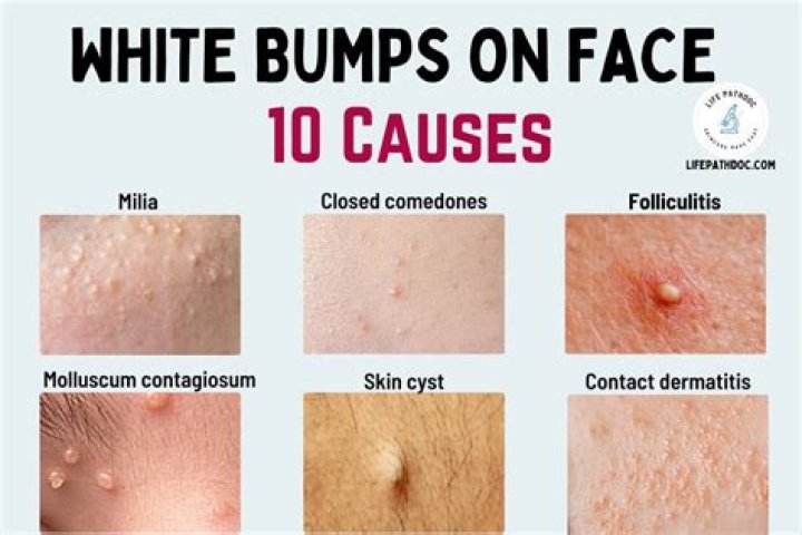 Bumps on the face