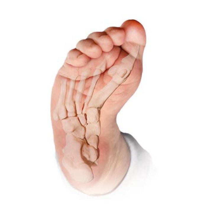 Curved foot part