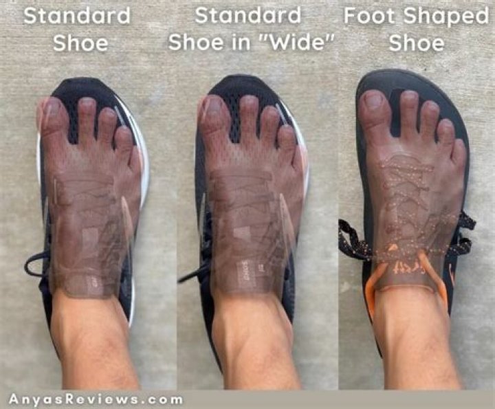 Digit often uncovered in a sandal
