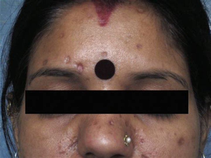 Dirty marks left by spills