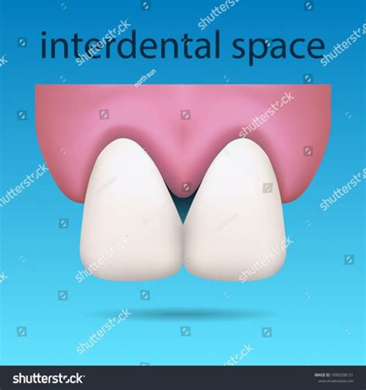 Empty space between teeth say