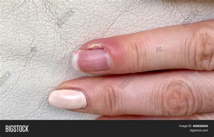 Finger part that's clipped and filed during a manicure