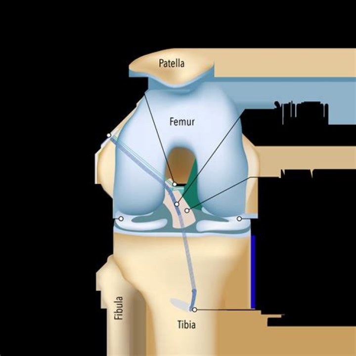 Fix a torn sleeve say