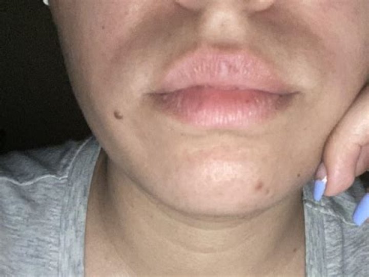 Get rid of a mustache