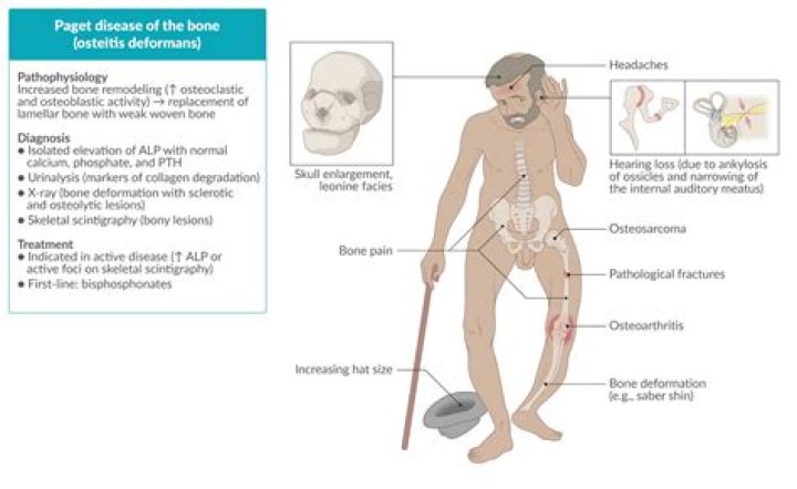 Has too many narcotics: Abbr.