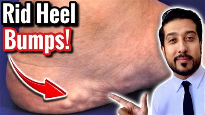 ___ in your heels (be stubborn)