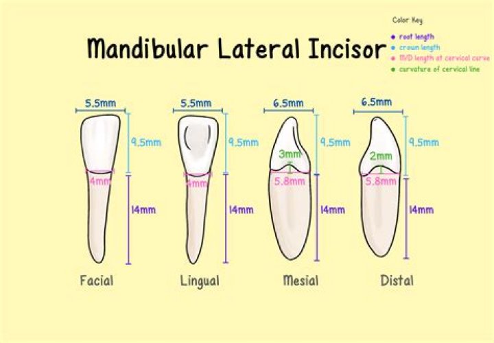 Incisor or molar for example
