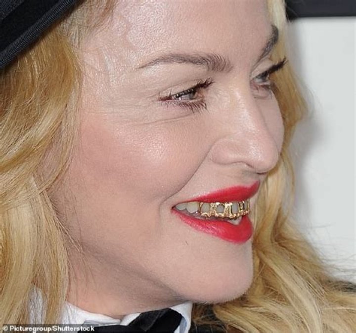 Madonna's front teeth have one