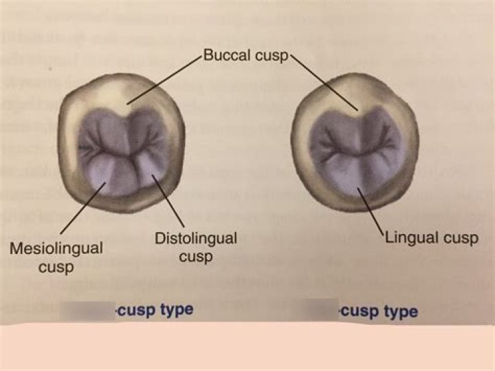 Molar or bicuspid for example