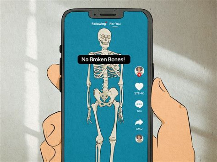 No broken bones just some scratches!: 2 wds.