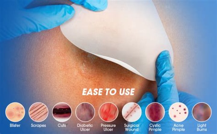 Paper ___ (tiny wounds that can be surprisingly painful)