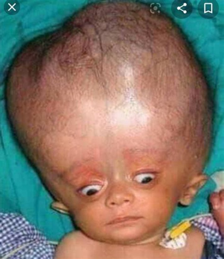 Problem for a bigheaded person