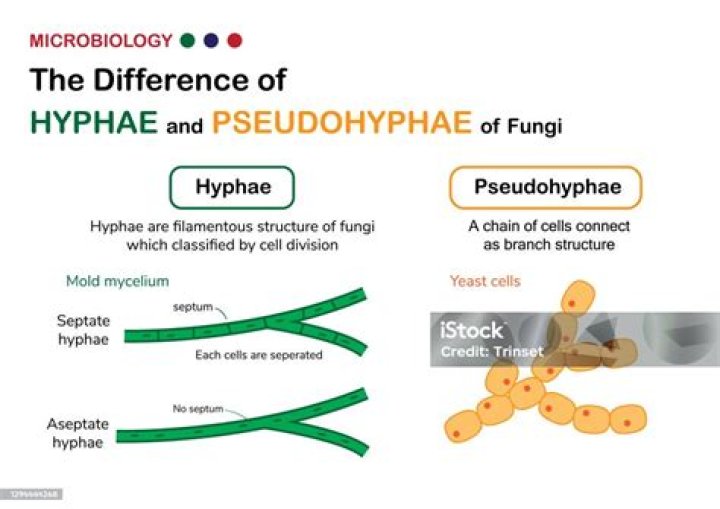 Relative via a spouse: Hyph.