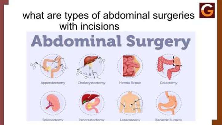 Surgery sites: Abbr.