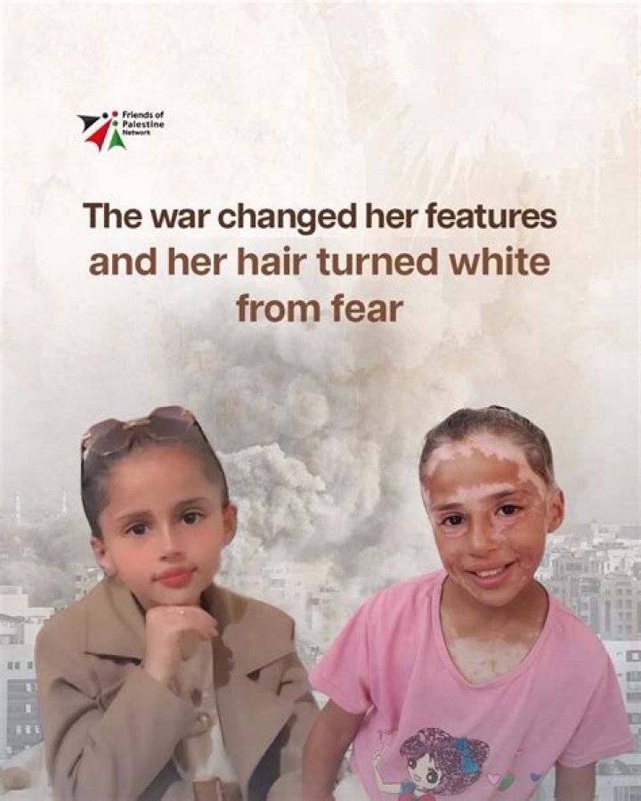 Turned white from fear