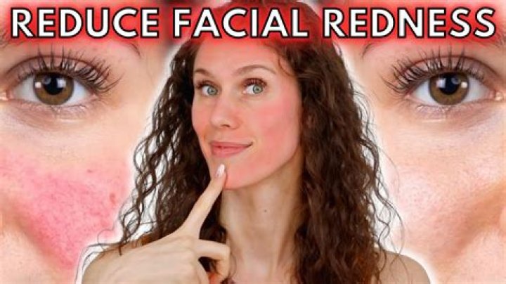 Turning red in the face